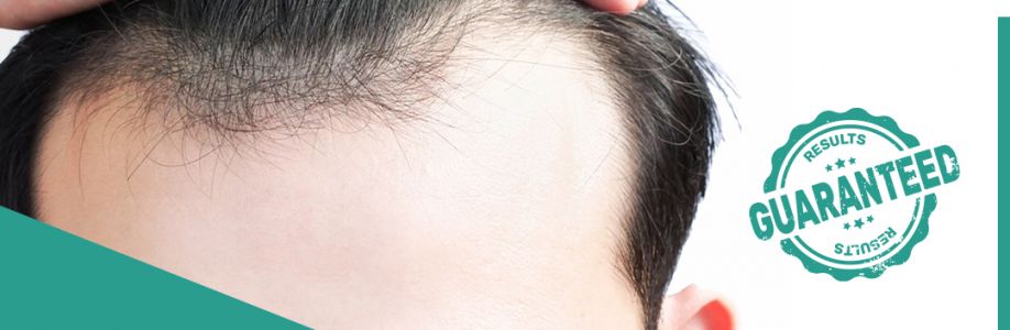 Best doctor for hair loss treatment in East Delhi Cover Image