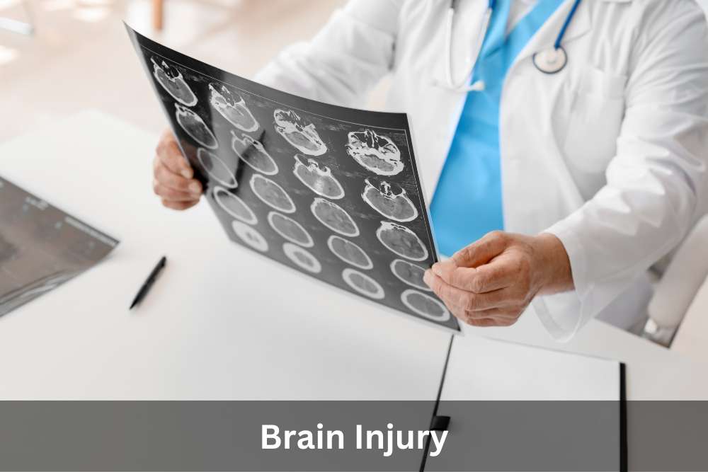 Charlottesville Traumatic Brain Injury Lawyer | Brain Injury Lawyer